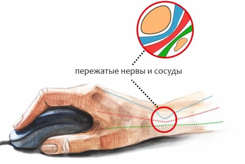 Восстановить аккаунт кракен